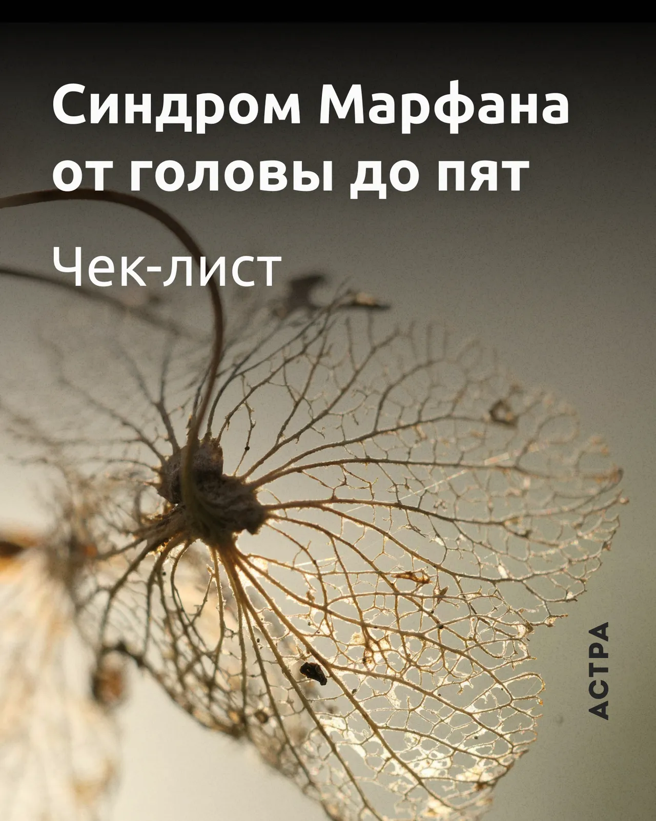 Чек-лист. Синдром Марфана от головы до пят